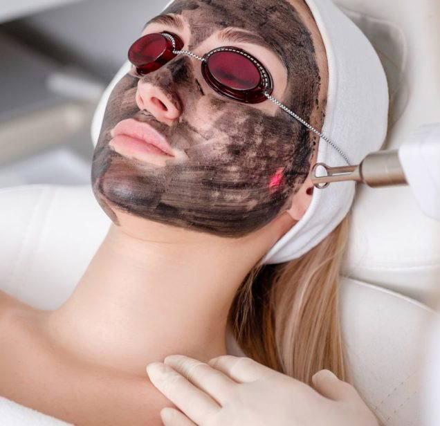 Close-up of cosmetologist's hand making hardware carbon peeling by young pretty customer woman in safety glasses headdress lying on couch in beauty salon. Facial cleaning concept. Cosmetology Services